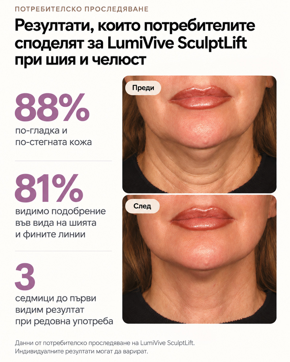 LumiVive SculptLift за шия