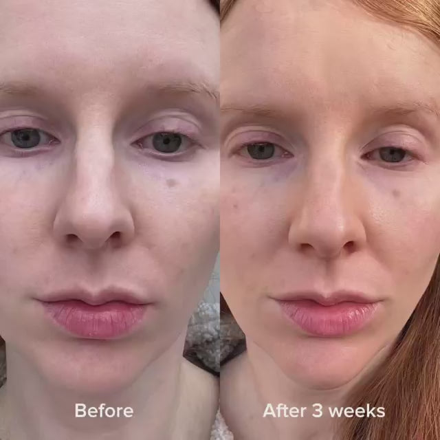 Зареждане на видео: 